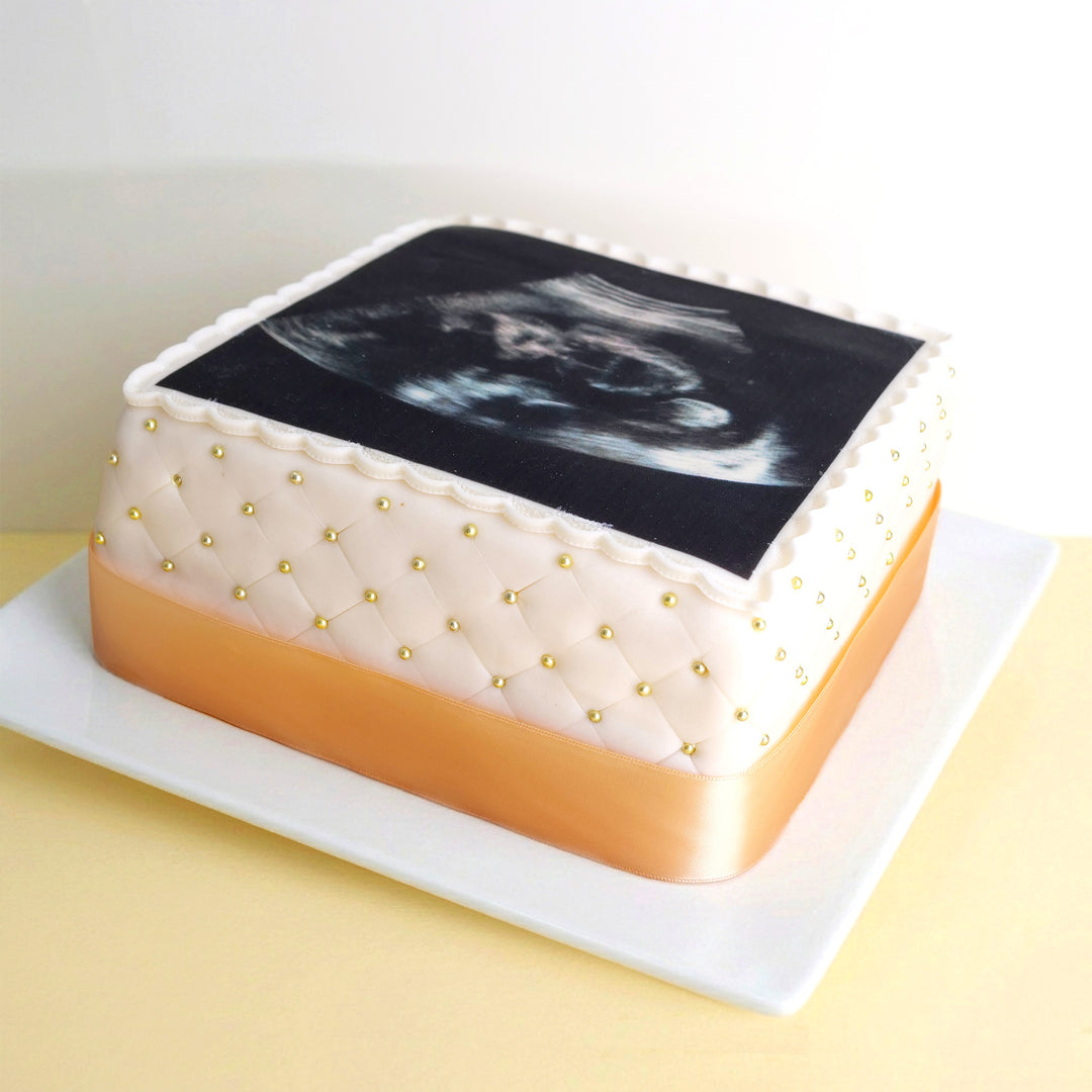 Gâteau échographie carré Deluxe avec votre propre photo - double hauteur