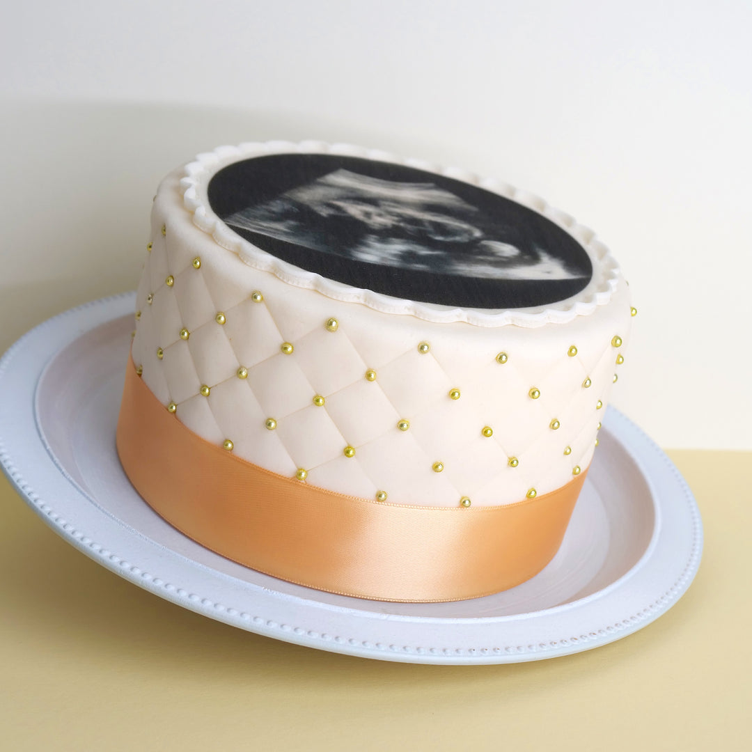 Gâteau échographie rond Deluxe - double hauteur